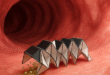 Nanorobots
