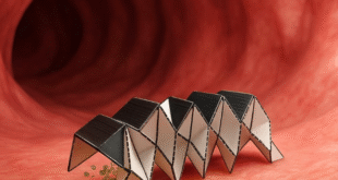 Nanorobots